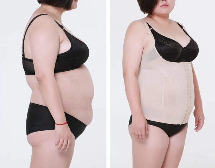 High Elastic Adjustable Slimming Body Shaper for Women – Plus Size Waist Corset Bodysuit