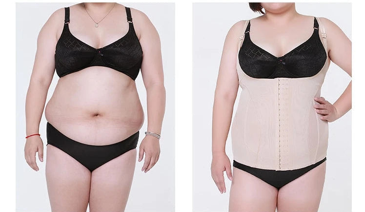 High Elastic Adjustable Slimming Body Shaper for Women – Plus Size Waist Corset Bodysuit
