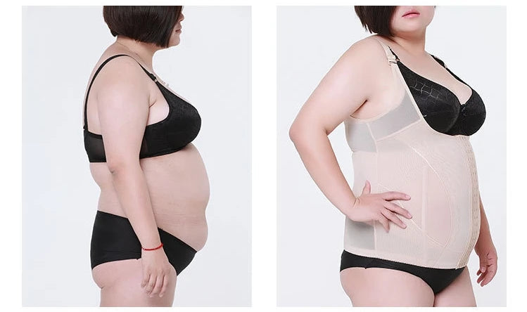 High Elastic Adjustable Slimming Body Shaper for Women – Plus Size Waist Corset Bodysuit